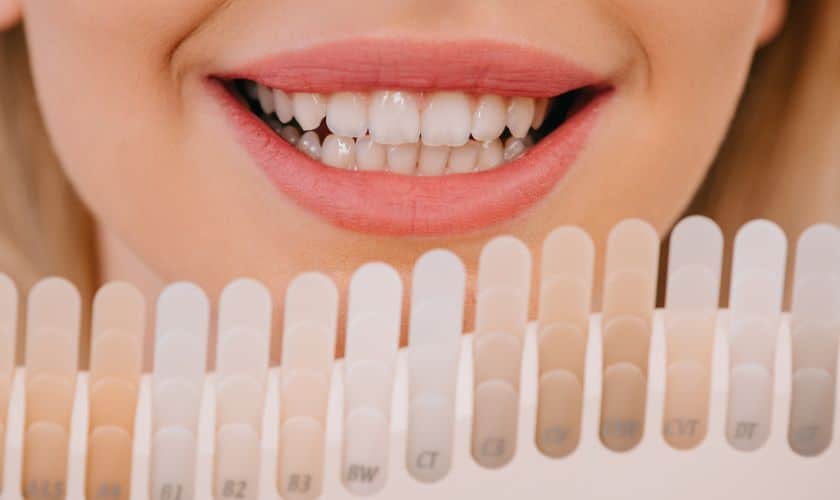 Guide to Teeth Whitening